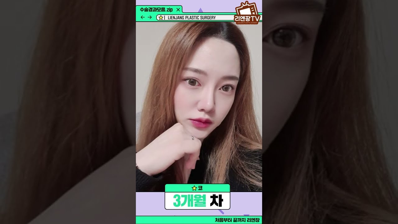 Лиенжанг гоо сайхны мэс заслын эмнэлэг: Хамарны мэс засал (үйл ажиллагааны болон гоо сайхны) #shorts