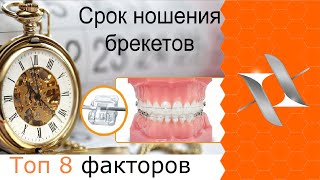 Топ 8 факторов, определяющих сроки ношения брекетов. Время ортодонтического лечения