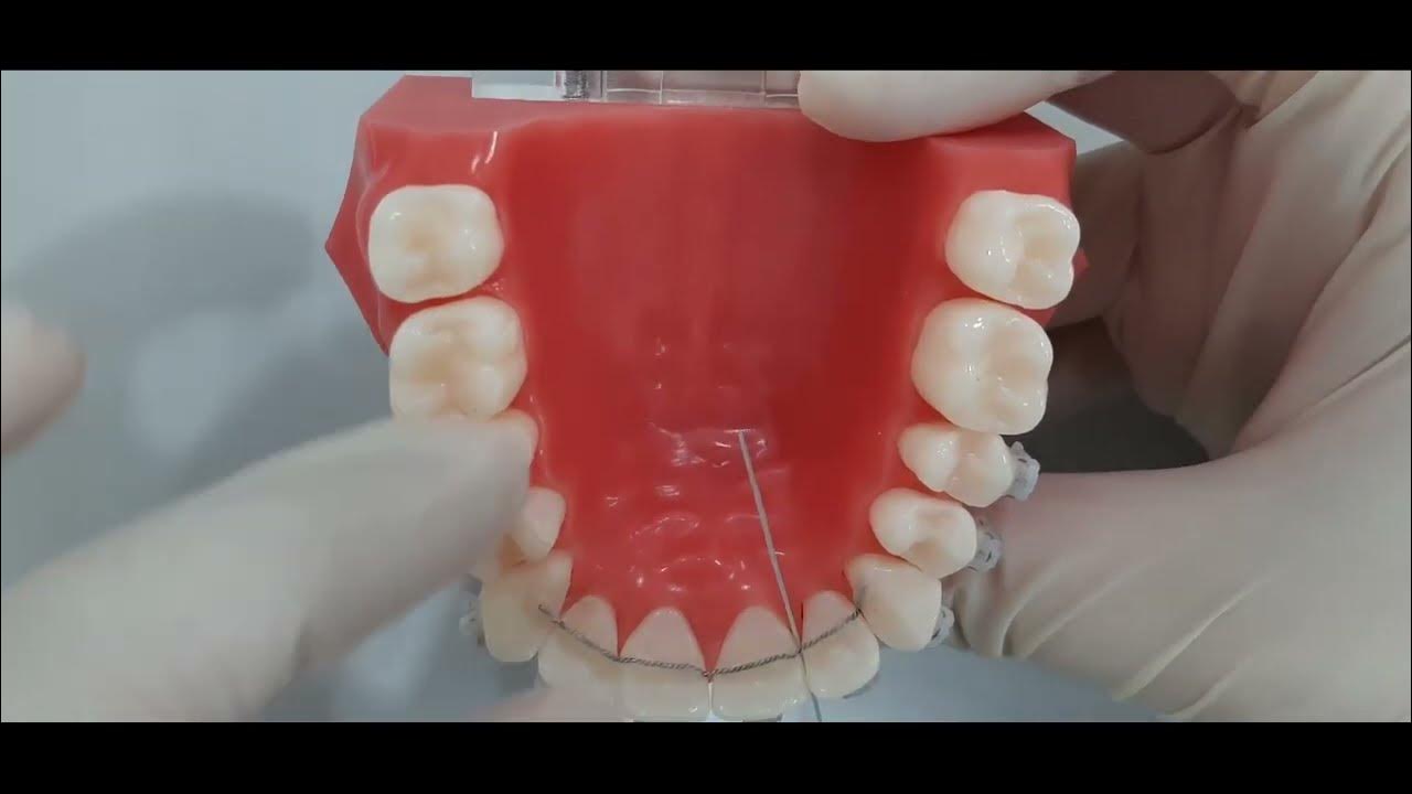 철사 유지 장치 치실 사용법 How to floss with fixed retainers(bonded retainers), 화성교정치과, 스마일팩토리 YouTube