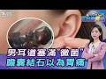 不是有人想你...男耳道塞滿「黴菌」! 以為胃痛...膽囊竟有「130顆結石」20260708｜主播#張蕙纖｜T台消費線 PODCAST｜TVBS新聞 @TVBSNEWS01