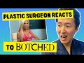 Does She Need Even BIGGER Breasts? Plastic Surgeon Reacts to BOTCHED - Dr. Anthony Youn