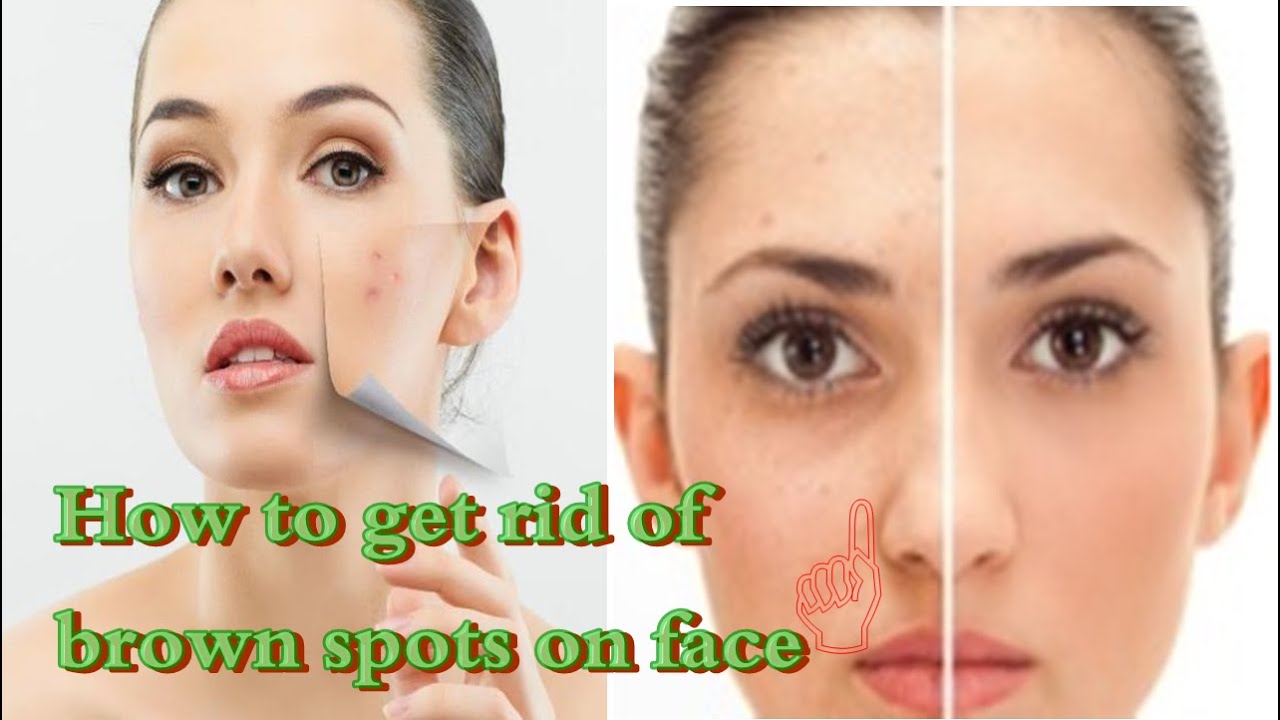 how to get rid of brown spots on face get rid of brown