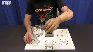 See How Three Amputees Regained Function With Robotic Hands