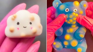 Crazy Pimple Popping in Mochi Toys - Satisfying Video Compilation