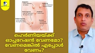 ഹെർണിയയ്ക്ക് ഓപ്പറേഷൻ വേണമോ? വേണമെങ്കിൽ എപ്പോൾ വേണം? | M&M Gastro Care India