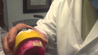 How to Set Maxillary Anterior Denture Teeth - Lingualized Non Balanced Occlusion