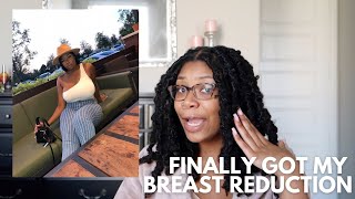 BREAST REDUCTION AT 22 | my story, tips, and before+after pics