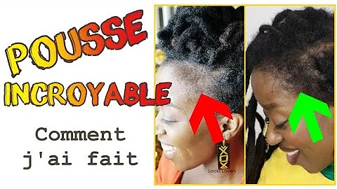 Comment savoir si on a des repousses de cheveux