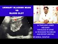 Bladder cancer | ultrasound of bladder cancer | bladder ultrasound | blood in the urine | Hematuria
