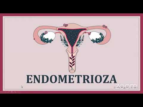 CroMSIC Osijek - Endometrioza