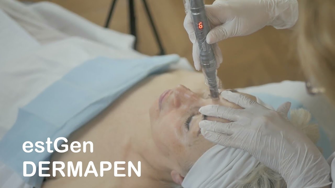 estGen + dermapen - zabieg odmładzający - antiageing skin facial
