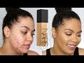 NARS Natural Radiant Longwear Foundation Review (oily/acne)