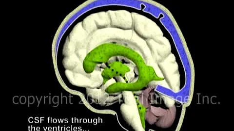 Hydrocephalus and Cerebrospinal Fluid  (CSF) circulation by Dr. Cal Shipley, M.D.