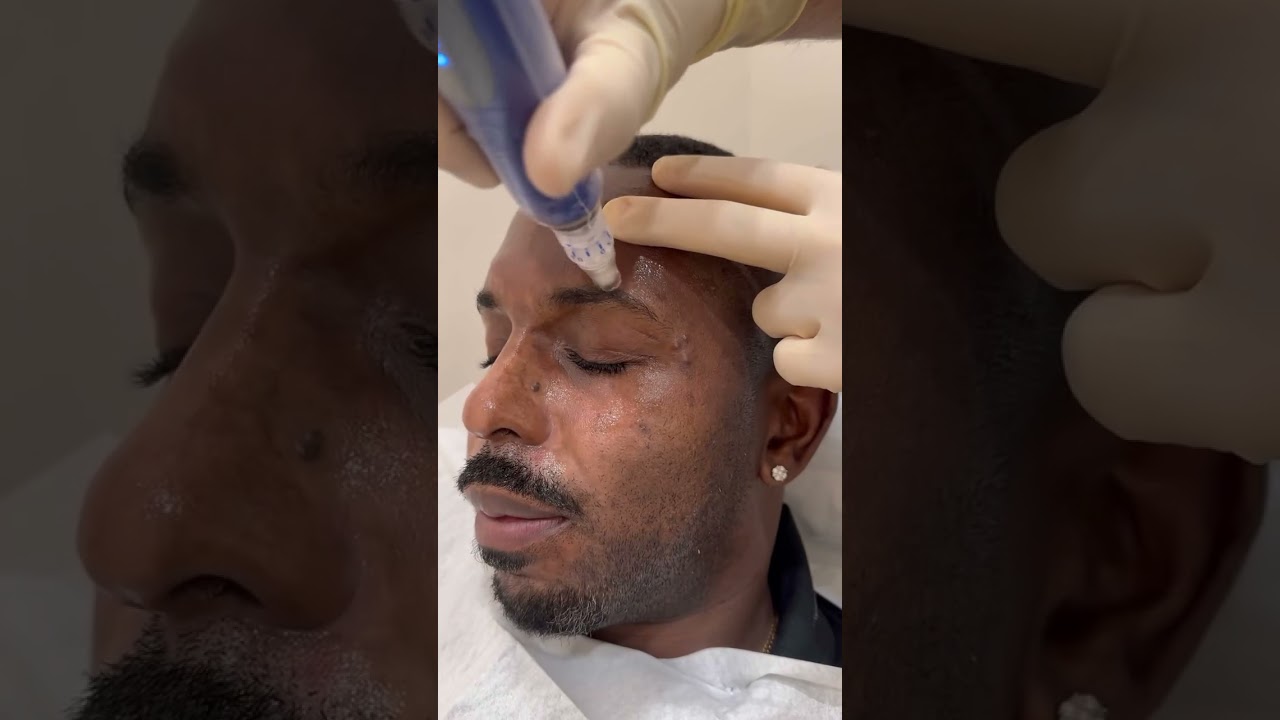 3 Best Aging Treatments for Men 