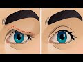 How To Treat Droopy Eyelids Naturally ( Amazing Result......100% Works)