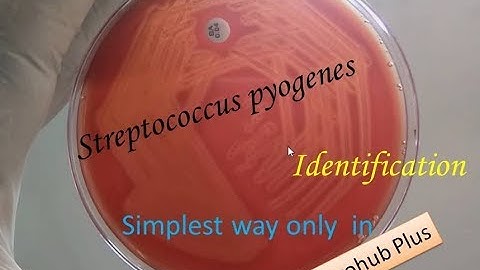 Streptococcus pyogenes identification