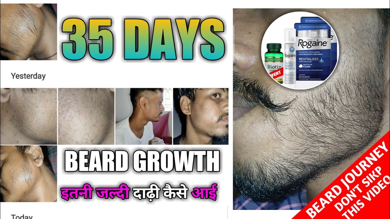 Beard ko kaise grow karen How to grow beard faster 35 days beard