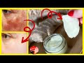 She Wiped Her Face With 1 Ingredient For 7 Nights and Removed DARK FACE SPOTS Instantly- Ginger Pads