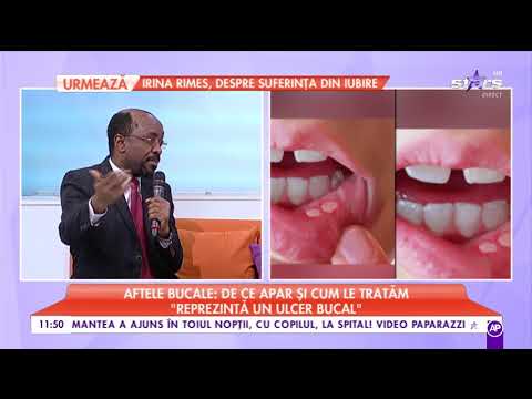 Video: Vapajul Poate Provoca Boli Orale