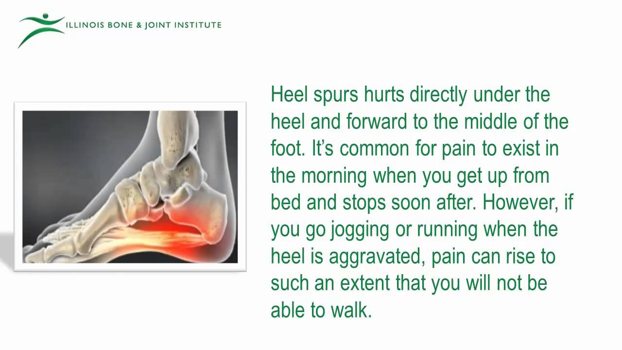 Causes and Symptoms of Heel Pain - YouTube