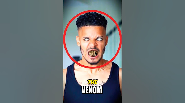 Real Life VENOM! 😱🕷