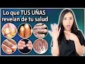 ¿Qué dicen TUS UÑAS sobre tu SALUD?👩🏻‍⚕️ l Dra. Pau Zúñiga