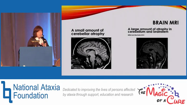 2016 NAF AAC - Management of Ataxia: Soup to Nuts