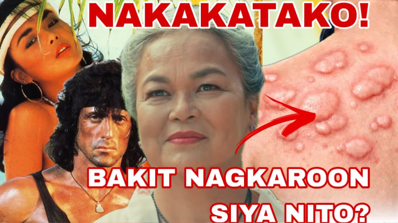 DATING SIKAT NA BOLD STAR TETCHIE AGBAYANI, BAKIT NAGKAROON NG GANITONG  SAKIT?