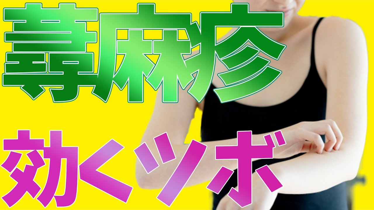 【蕁麻疹 ツボ 治し方】蕁麻疹の治し方に効くツボでお悩みなら中野の哲学堂鍼灸院 - YouTube