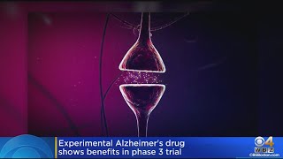 Experimental Alzheimer's drug shows benefits in phase 3 trial