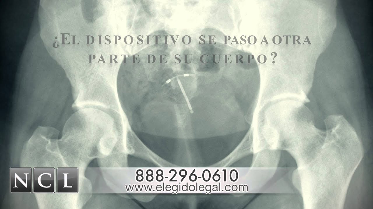 Mirena IUD Injury Law Firm Los Angeles Spanish Commercial YouTube