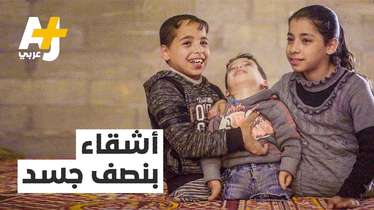 هل يؤدي زواج الأقارب إلى حدوث تشوهات لدى الأطفال؟
