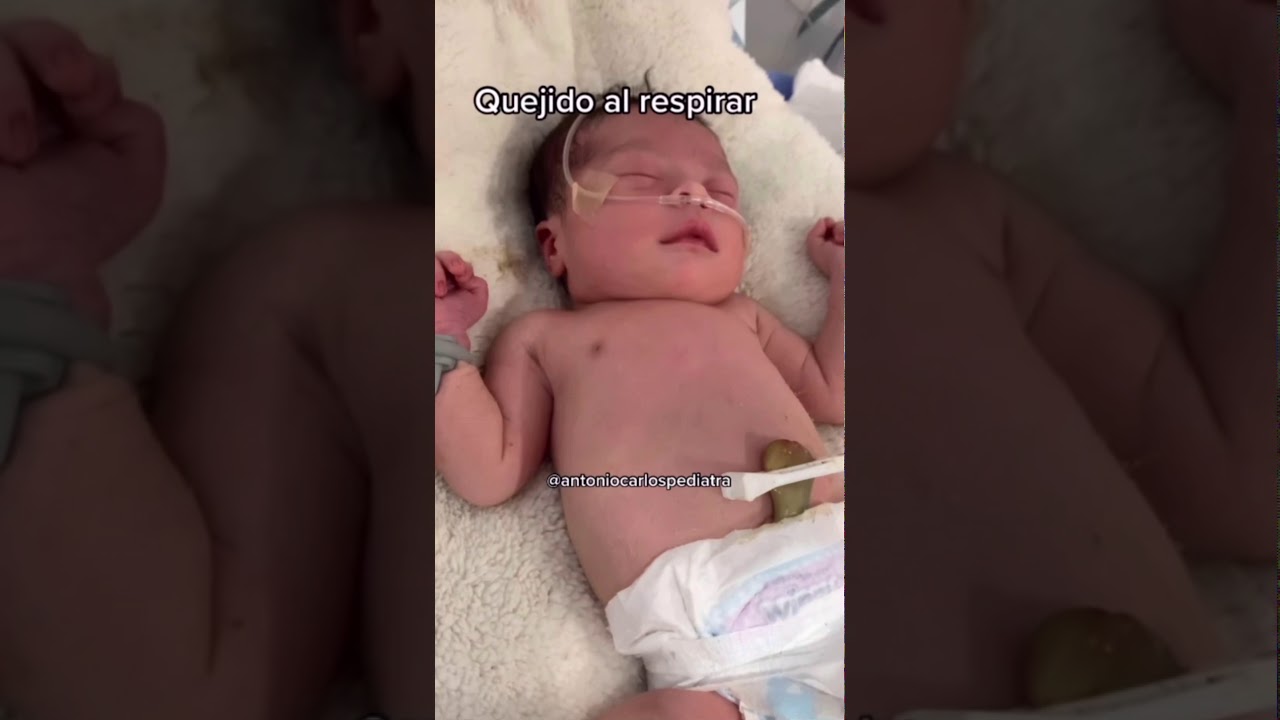 Síndrome de dificultad respiratoria del recién nacido YouTube Síndrome de dificultad respiratoria del recién nacido YouTube