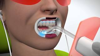WHITEsmile Light Whitening AC Instruction English
