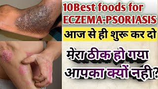 10 best foods for psoriasis, Eczema, fungal infection patient to avoid itching and inflammation.
