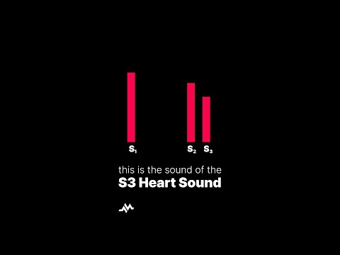 S3 Heart Sound