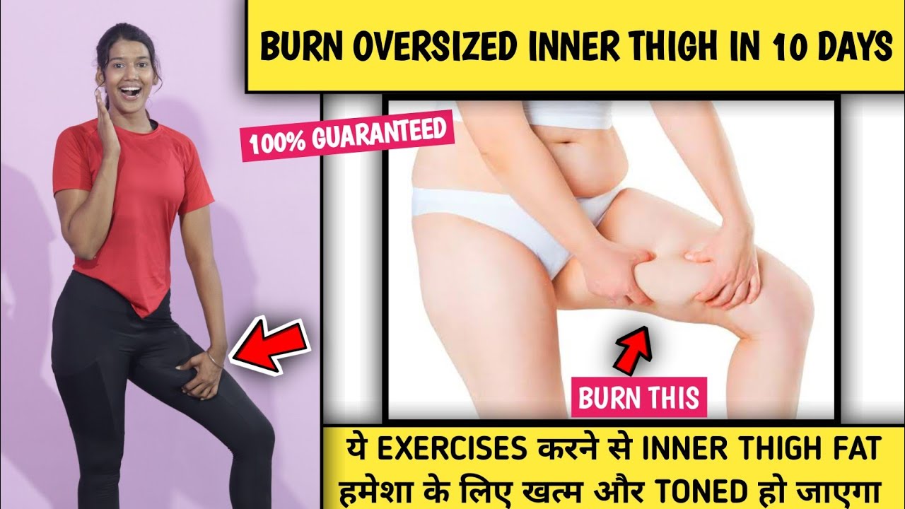 Burn oversized Inner Thigh in 10 Days