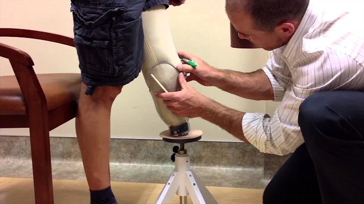 The Check Socket Fitting | limb-loss.org