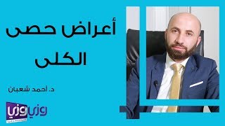 أعراض حصى الكلى