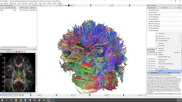 DSI Studio Workshop (Oct 21 2022) Wk7: Correlational Tractography