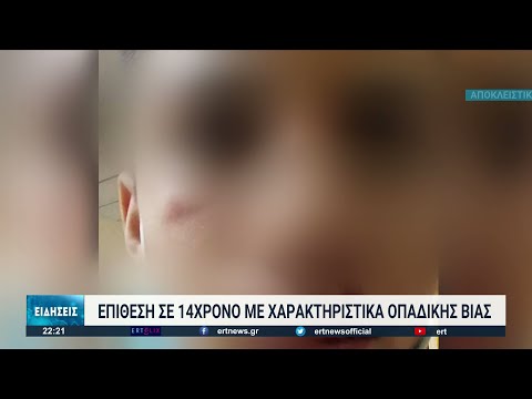 Θεσσαλονίκη: Επίθεση με χαρακτηριστικά οπαδικής βίας σε 14χρονο | 01/02/2022 | ΕΡΤ