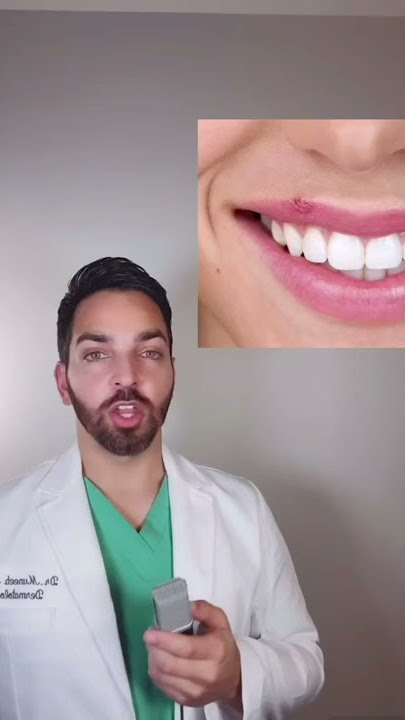 COLD SORES ON THE LIPS? #shorts