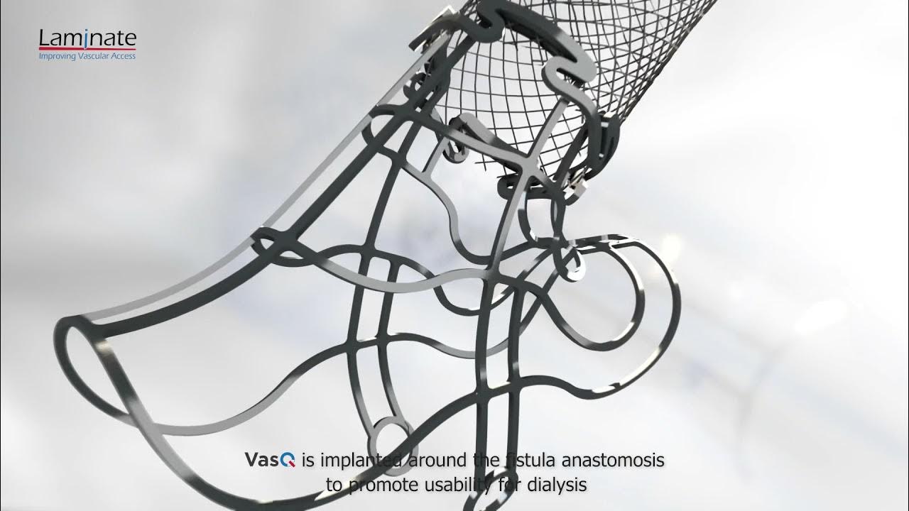 Laminate Medical Technologies VasQ Device YouTube