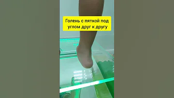 Вальгус 3 степени. Читай описание, чтобы знать больше.
