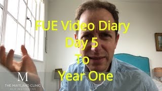 "George" Patient FUE Hair Transplant Diary - Day 5 to Year 1