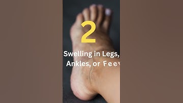 Thumbnail of 5 Warning Signs of a Weak Heart You Must Know! | Heart Health Tips