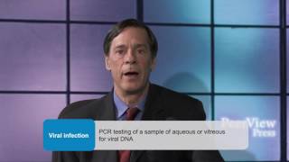 Improving Outcomes in Patients With Uveitis