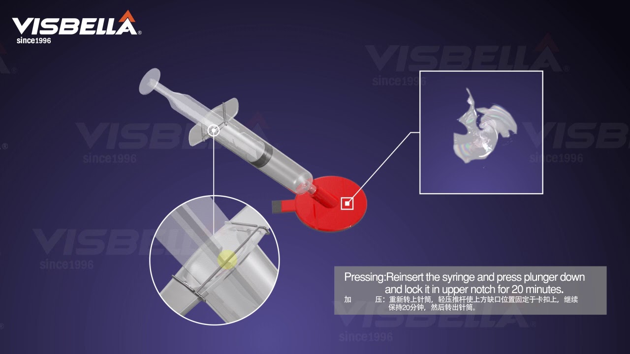 Kit de réparation de fissures pour pare-brise pare-brise de Visbella DIY.  Puce de rechange Fissure - Chine Réparation de pare-brise, réparation de  fissure de puce de pare-brise