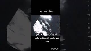 سونار متابعه معى وصفه ونظام الحمل بولد وتحويل الرحم قلوى ما شاء الله ولد