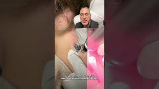 Laser Tattoo Removal